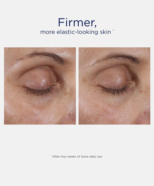 Intensive Eye Therapy