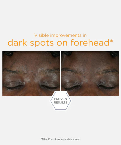 after 12 weeks neostrata serum