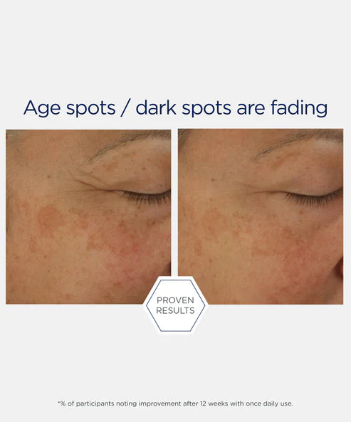 age spots proven results