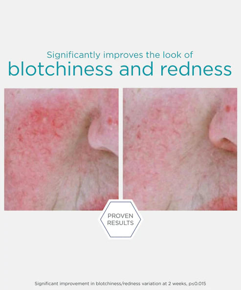 neostrata blotchinness 