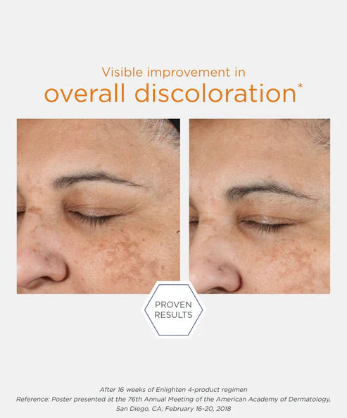 proven results enlighten 