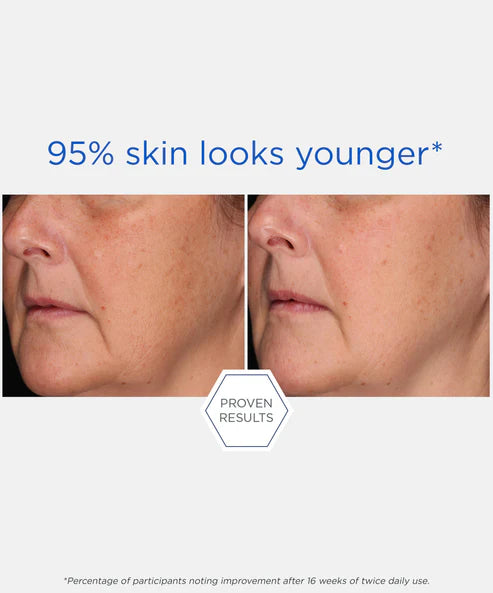 skin looks younger